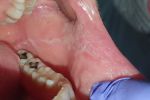 Naukowcy z Wrocławia prowadzą badania nad zgrzytaniem zębami, UMED Wrocław