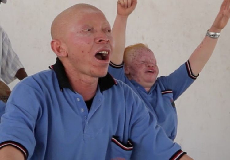 Sztuka jako broń przeciwko ubóstwu. Albinosi na Brave Festivalu, Materiały prasowe