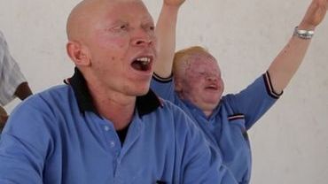 Sztuka jako broń przeciwko ubóstwu. Albinosi na Brave Festivalu