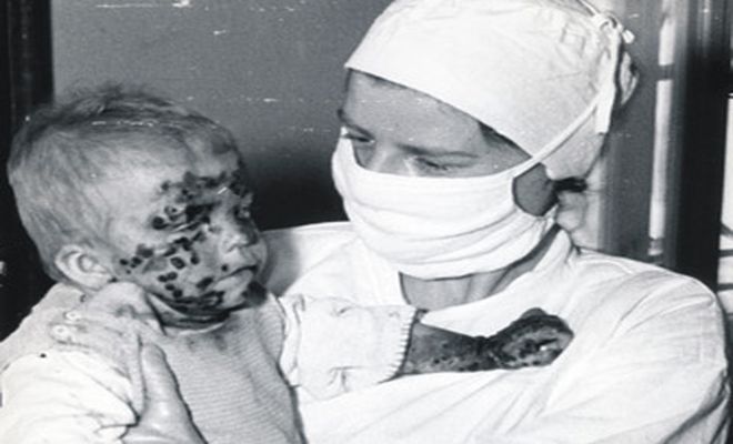 Epidemia czarnej ospy we Wrocławiu w 1963 roku